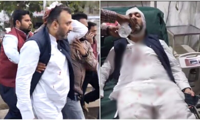 PCC : PCC दफ्तर में कांग्रेस के ही दूसरे गुट ने किया जानलेवा हमला…पूर्व जिला अध्यक्ष के खिलाफ FIR दर्ज…VIDEO PCC : PCC दफ्तर में कांग्रेस के ही दूसरे गुट ने किया जानलेवा हमला…पूर्व जिला अध्यक्ष के खिलाफ FIR दर्ज…VIDEO
