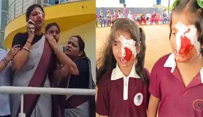 छत्तीसगढ़-बलरामपुर रामानुजगंज में बच्चों की आंख से बह रहा खून, मोबाइल की लत से बचाने स्कूल का अनोखा तरीका छत्तीसगढ़-बलरामपुर रामानुजगंज में बच्चों की आंख से बह रहा खून, मोबाइल की लत से बचाने स्कूल का अनोखा तरीका