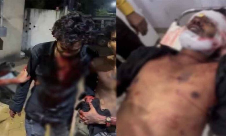छत्तीसगढ़-दुर्ग में पारिवारिक विवाद में चली तलवारें, युवकों ने एक-दूसरे को किया लहूलुहान छत्तीसगढ़-दुर्ग में पारिवारिक विवाद में चली तलवारें, युवकों ने एक-दूसरे को किया लहूलुहान