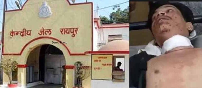 रायपुर सेन्ट्रल जेल के बाहर चली गोली, एक युवक गंभीर