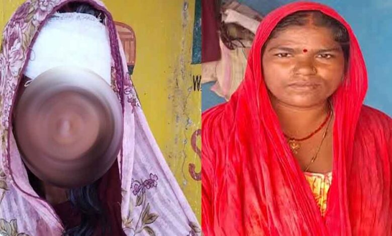 छत्तीसगढ़-बलरामपुर रामानुजगंज में महिला की बचाई जान, दुर्घटना में सर फूटने पर मदद कर लोगों ने करवाया इलाज छत्तीसगढ़-बलरामपुर रामानुजगंज में महिला की बचाई जान, दुर्घटना में सर फूटने पर मदद कर लोगों ने करवाया इलाज