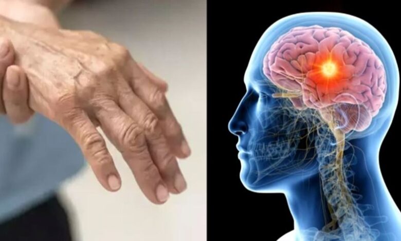 इलेन बैरेगु सिंड्रोम: महाराष्ट्र में अब तक 127 मामलों की पुष्टि, दो मौतें इलेन बैरेगु सिंड्रोम: महाराष्ट्र में अब तक 127 मामलों की पुष्टि, दो मौतें