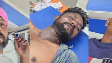 खेत में बड़ा हादसा: हार्वेस्टर चालक समेत तीन लोग 11kV तार की चपेट में आने से बुरी तरह झुलसे