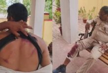 बालोद में पर्रकुलेशन टेंक का निरीक्षण करने पहुंची वन विभाग की टीम पर लाठी-डंडे से हमला, डिप्टी रेंजर समेत 4 घायल