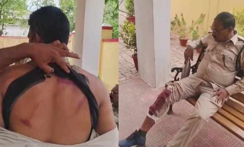 बालोद में पर्रकुलेशन टेंक का निरीक्षण करने पहुंची वन विभाग की टीम पर लाठी-डंडे से हमला, डिप्टी रेंजर समेत 4 घायल बालोद में पर्रकुलेशन टेंक का निरीक्षण करने पहुंची वन विभाग की टीम पर लाठी-डंडे से हमला, डिप्टी रेंजर समेत 4 घायल