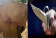 CG Crime- राजधानी में बेखौफ अपराधियों का कहर : ऑटो चालक से चाकू की नोक पर लूट, विरोध करने पर की बेरहमी से पिटाई….