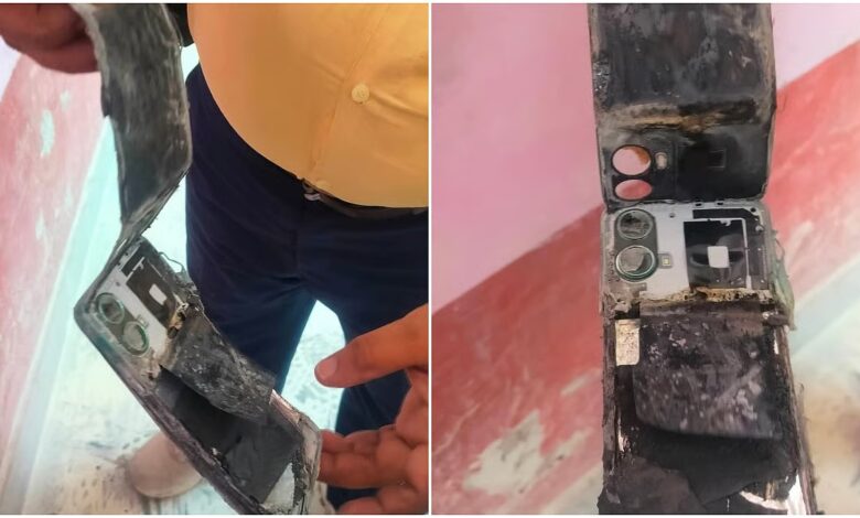 अस्पताल में मरीज की जेब में फट गया मोबाइल अस्पताल में मरीज की जेब में फट गया मोबाइल