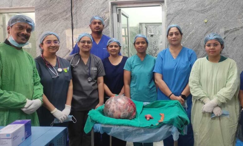 रायपुर : सिम्स में जटिल सर्जरी, 65 वर्षीय महिला के पेट से निकाला गया 10 किलो से अधिक वजन का ट्यूमर रायपुर : सिम्स में जटिल सर्जरी, 65 वर्षीय महिला के पेट से निकाला गया 10 किलो से अधिक वजन का ट्यूमर